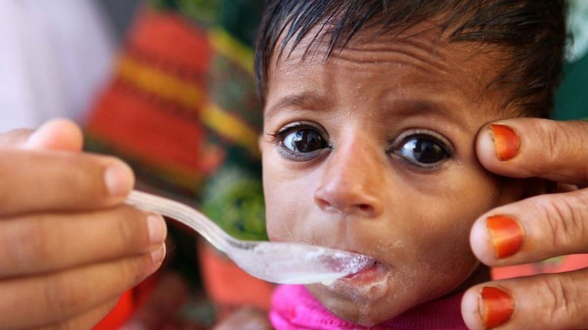 Hambre en Argentina: "La desnutrición en los niños es un cuadro irreversible"