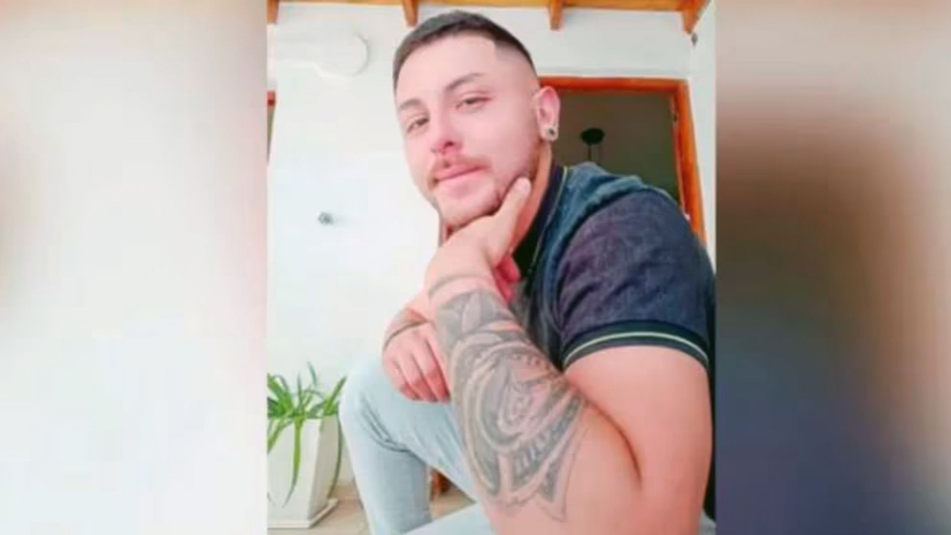 Murió el argentino de 28 años que había contraído viruela del mono en México