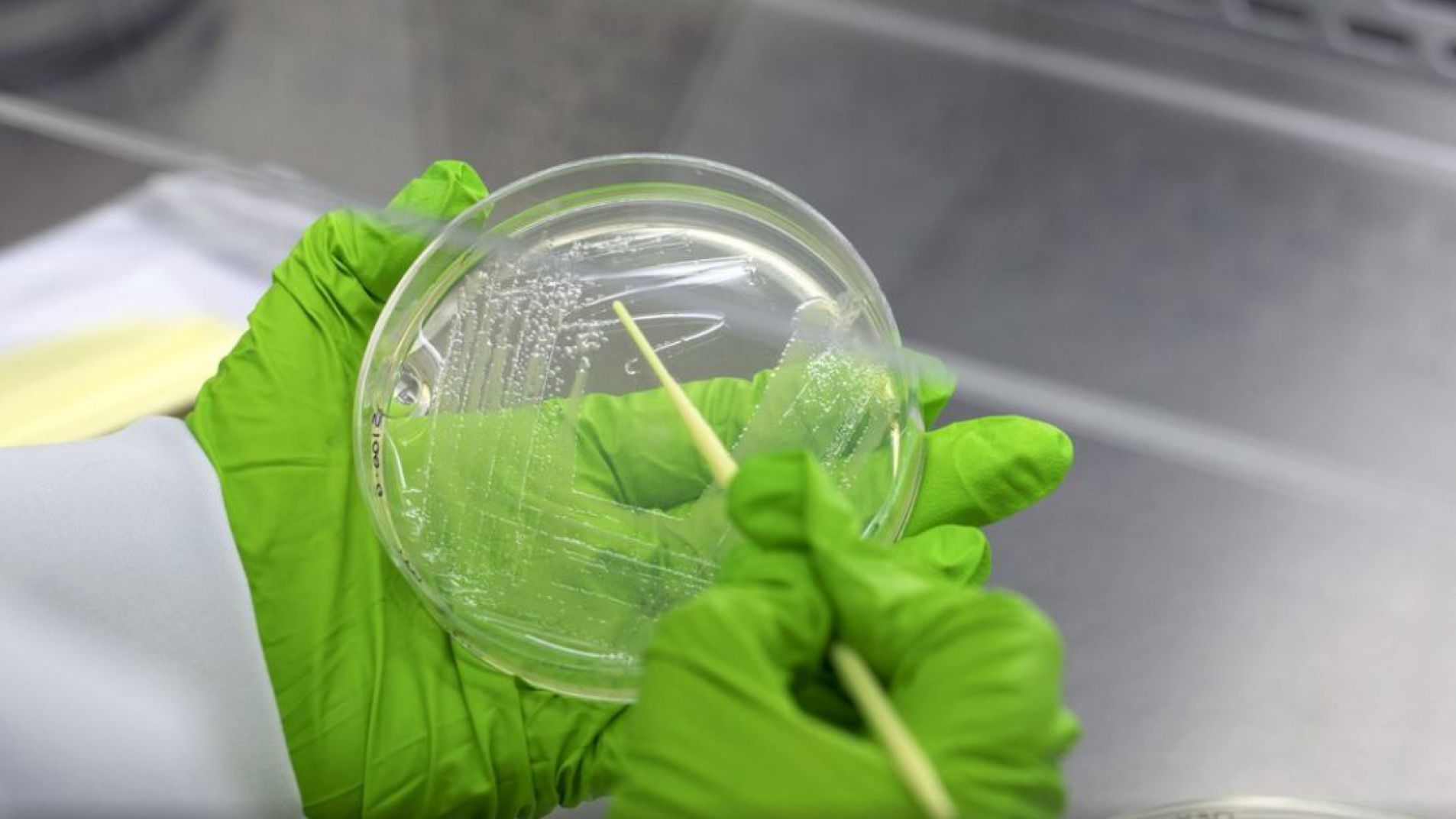 Suba de muertes por infecciones que ahora resisten a los antibióticos