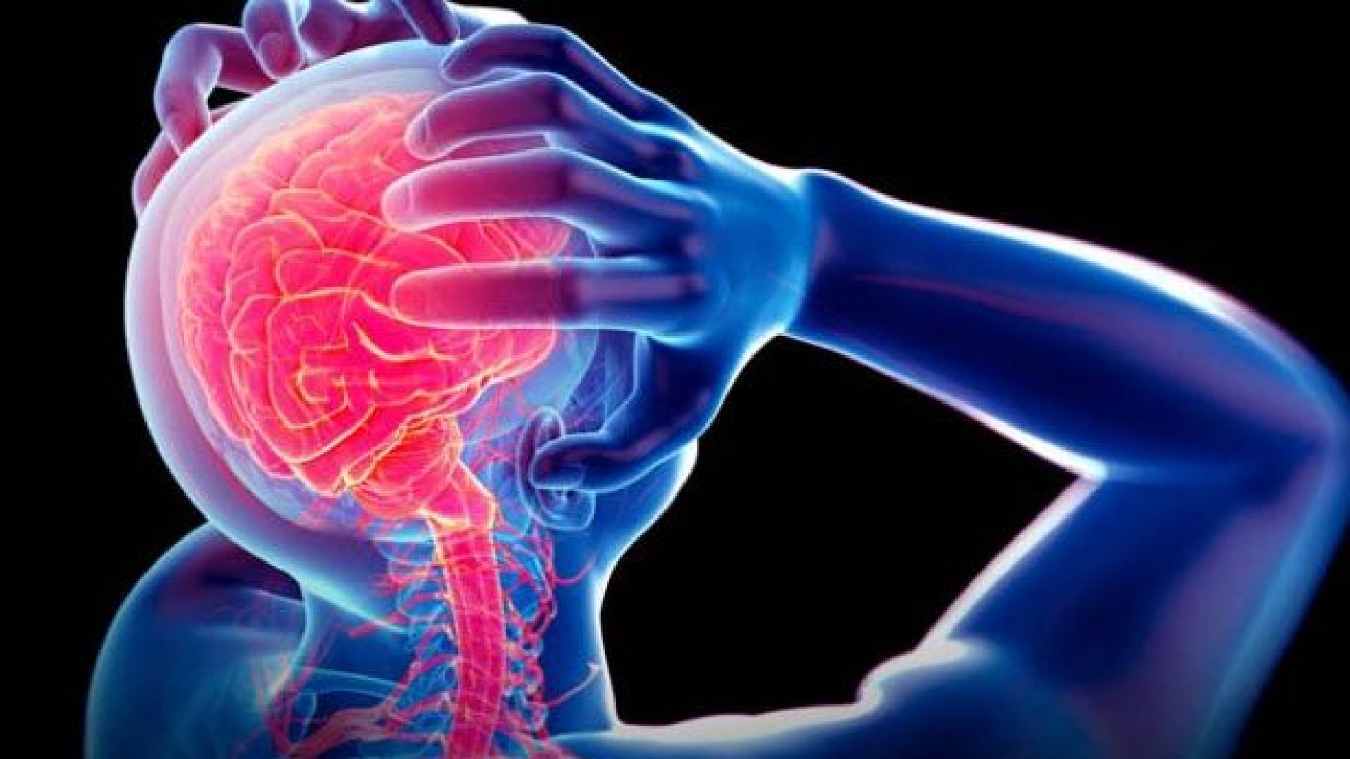 Migraña: un tipo de cefalea que puede prevenirse y tratarse