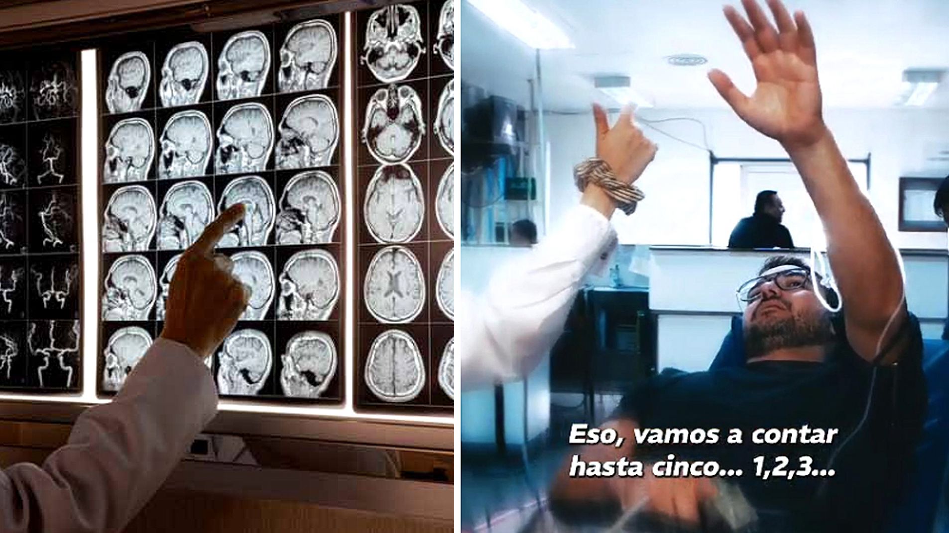 Concientizan sobre la prevención del ACV: conocé cómo detectarlo y qué hacer