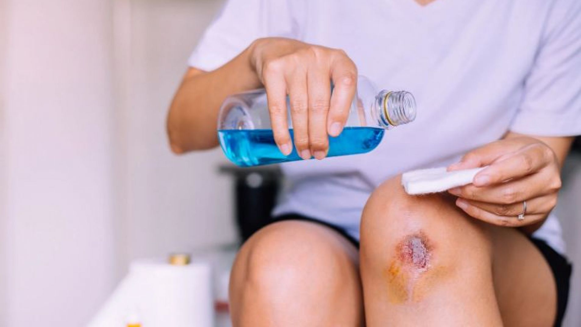 No uses agua oxigenada ni alcohol para desinfectar heridas