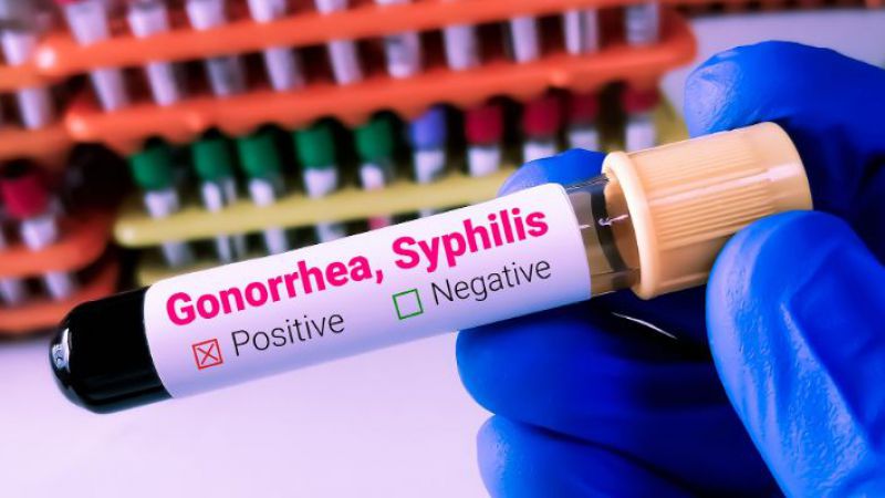 La sífilis en Mendoza sigue en ascenso