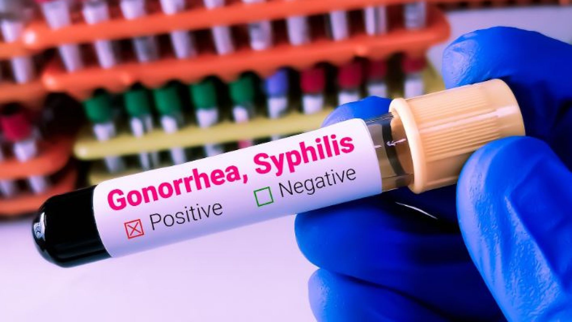 Sífilis: la infección de transmisión sexual de la que debes cuidarte