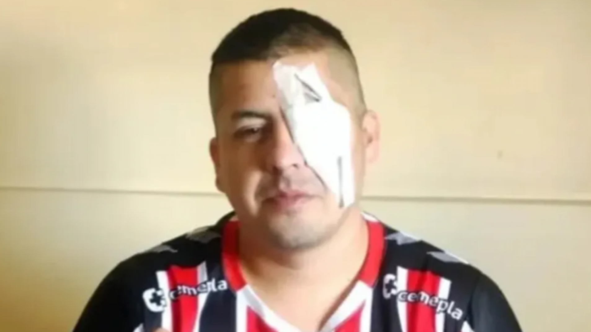 Marcha jubilados: Un hincha de Chacarita denunció que perdió un ojo