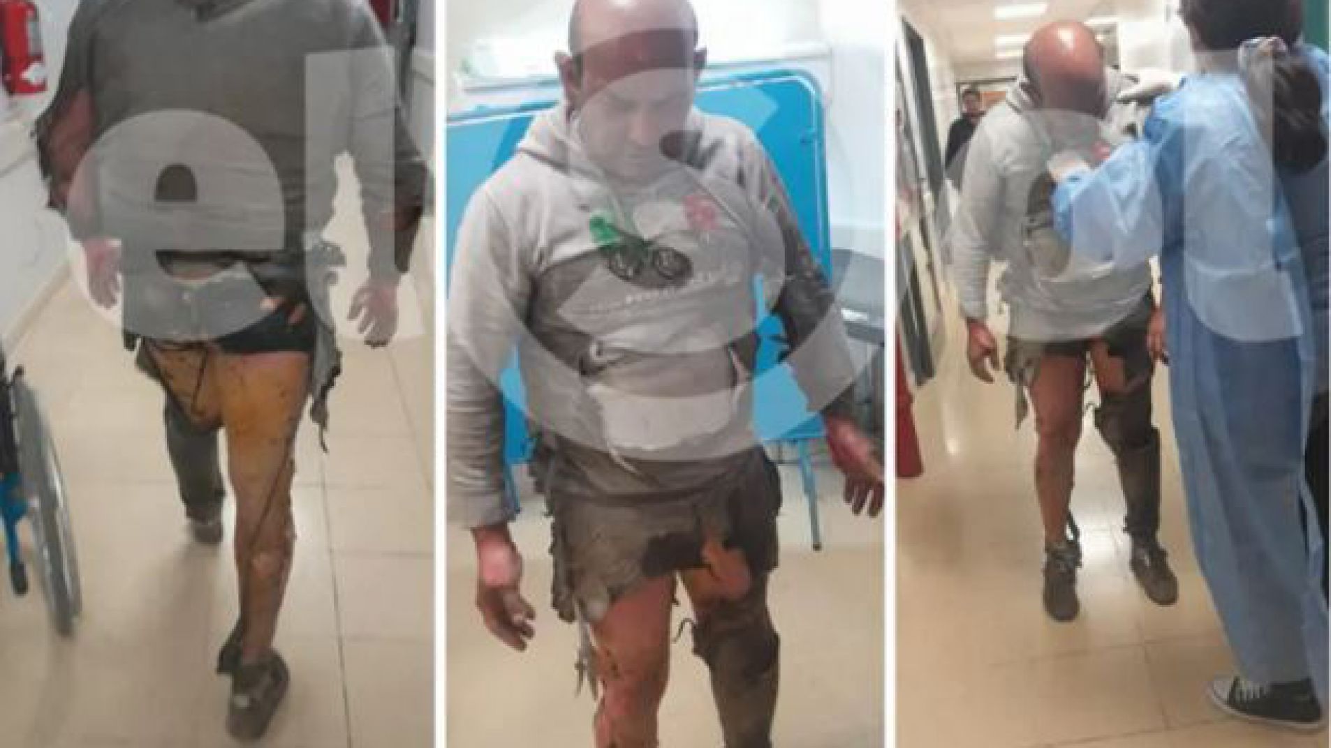 Rolando Celedón prendió fuego la casa, mató a su familia y se quemó el 40% de su cuerpo (foto Diario El Sol).