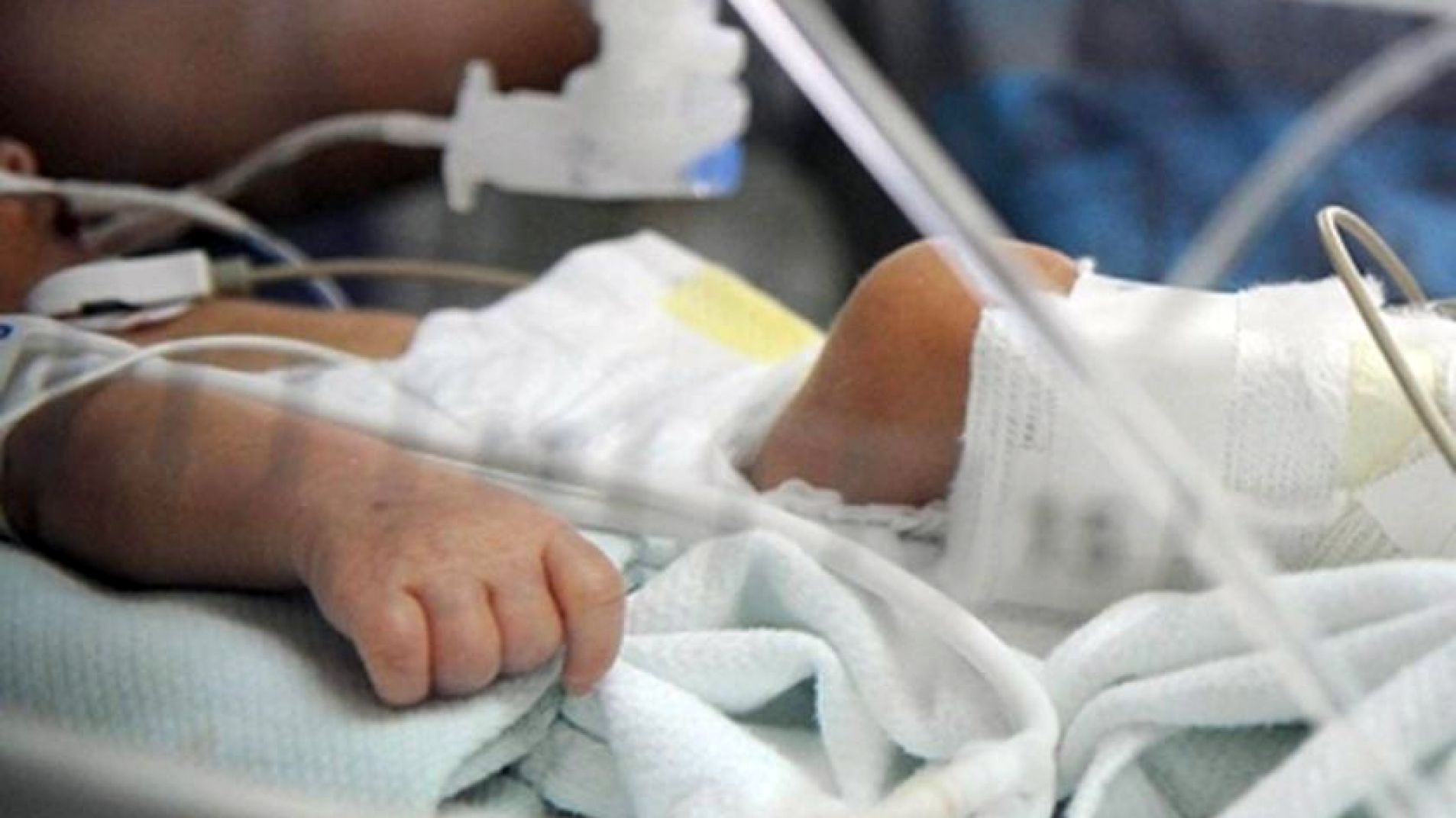 "Se empezó a sentir olor a carne quemada": quemaron a una bebé recién nacida