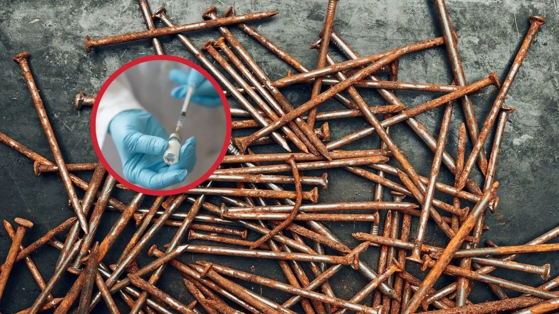 La ciencia responde: ¿Los clavos oxidados causan el tétanos?