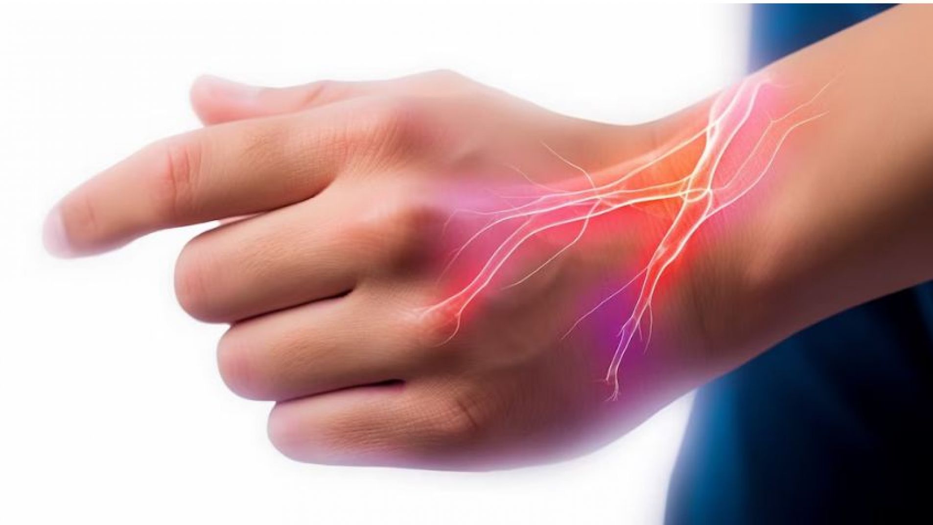 Cómo prevenir el síndrome del túnel carpiano y cuáles son los síntomas
