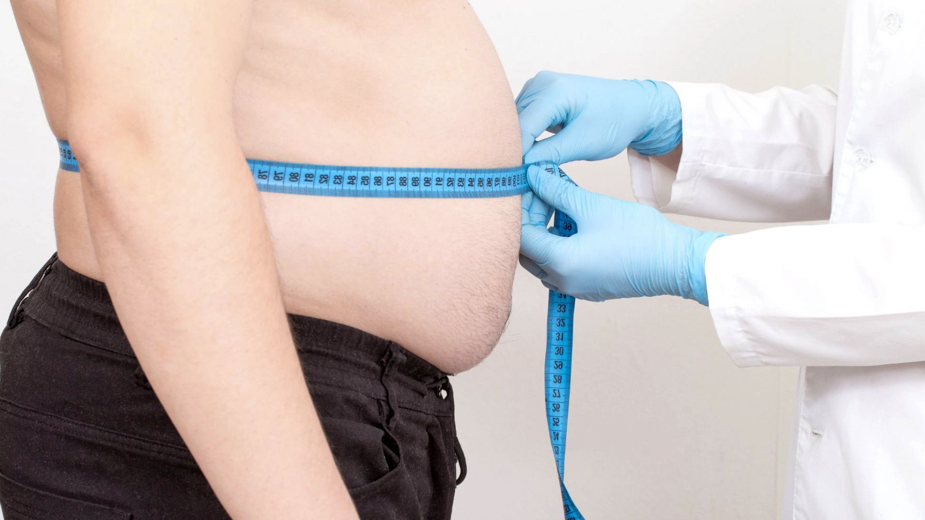 Cirugía bariátrica: la Argentina redefine el tratamiento de la obesidad