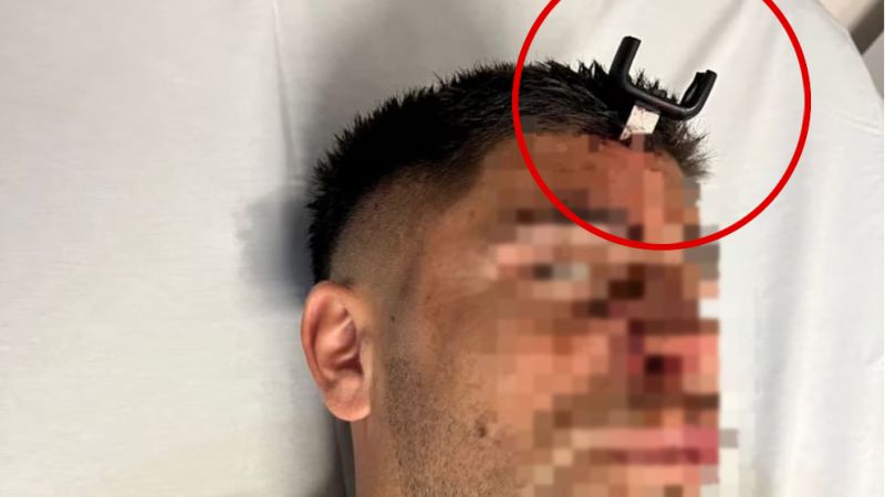 Tras una discusión le clavaron una llave en la cabeza a un jugador (Video)