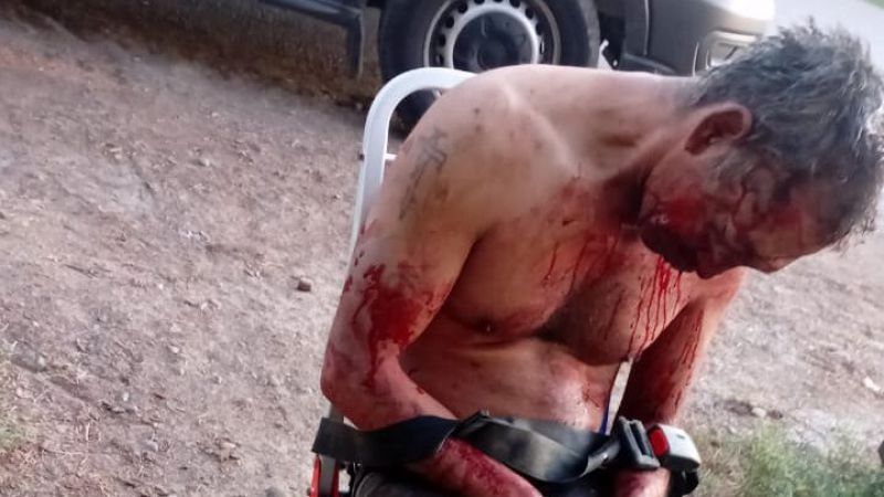 Descubrió que su novia le era infiel con su tío, lo atacó y lo dejó en grave estado