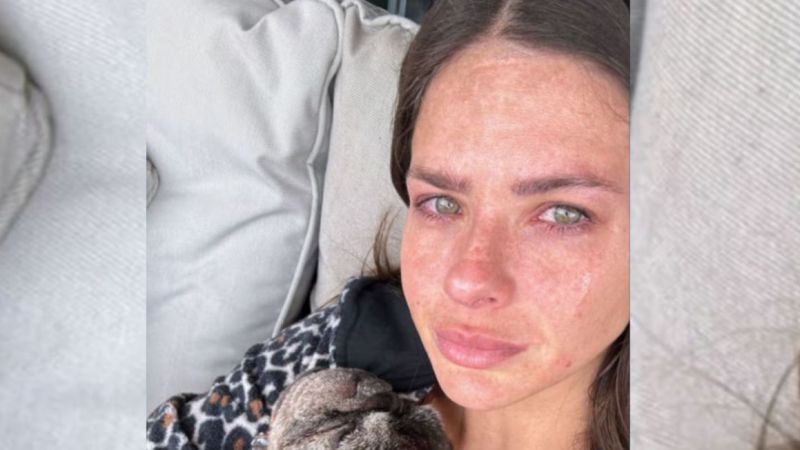 "Me rompí el tabique": la China Suárez sufrió un accidente en pleno rodaje