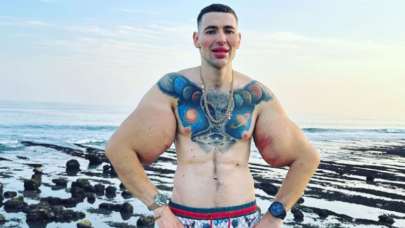 La dramática confesión del "Popeye ruso", quien podría perder los dos brazos