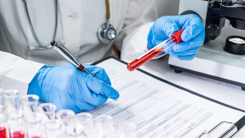 VIH: por qué los contagios no bajan pese a los nuevos métodos de prevención