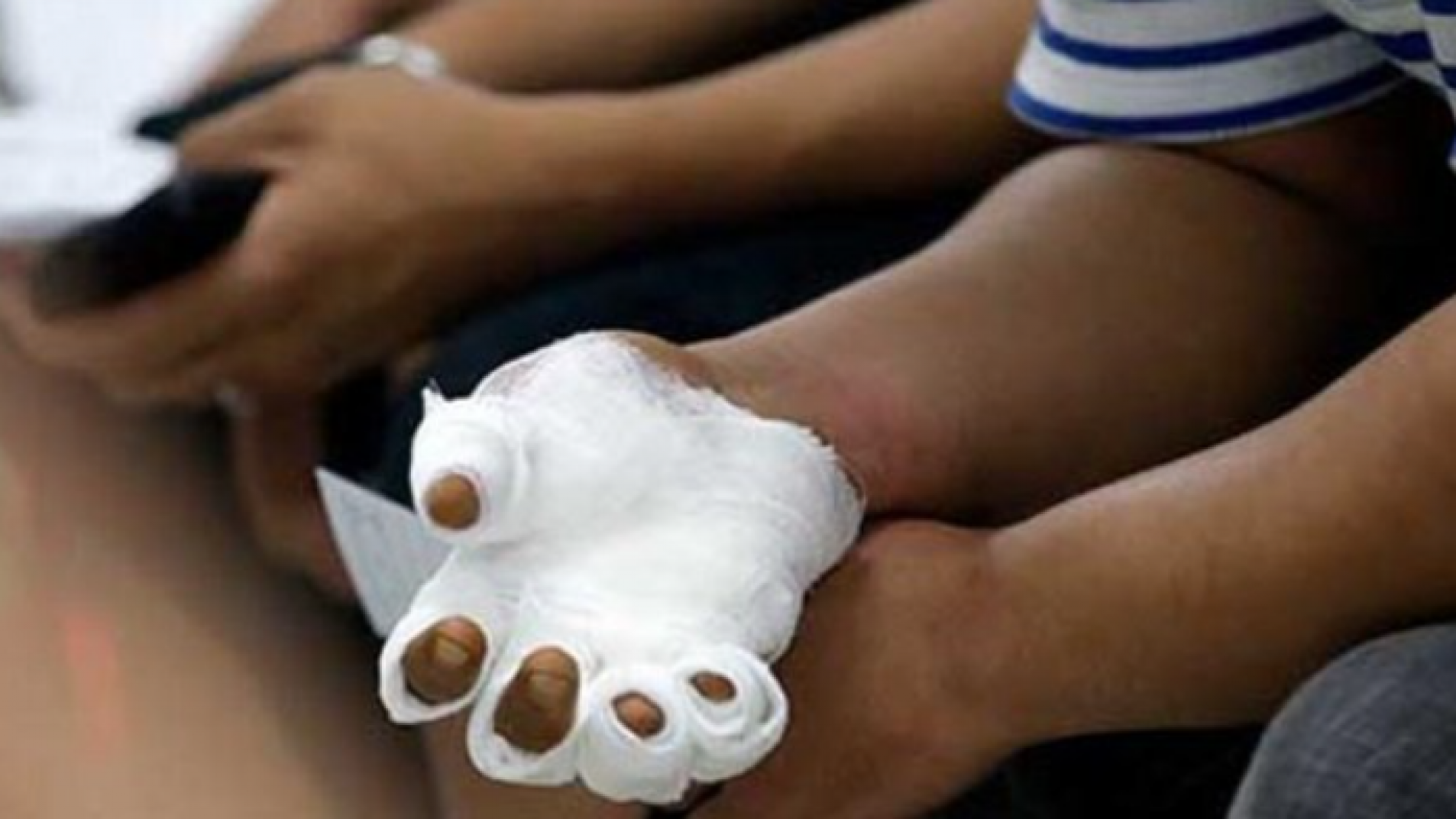 Fueron 11 las personas heridas por el uso de la pirotecnia en Mendoza