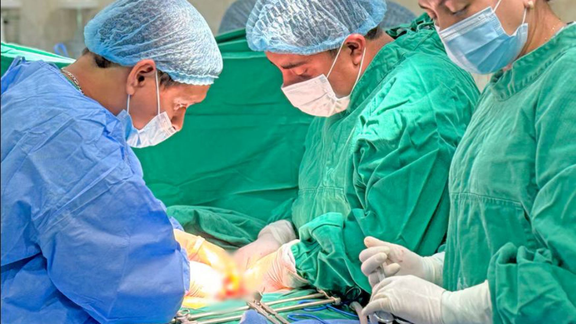 Argentina: récord histórico de donación de órganos y nueva etapa en trasplantes