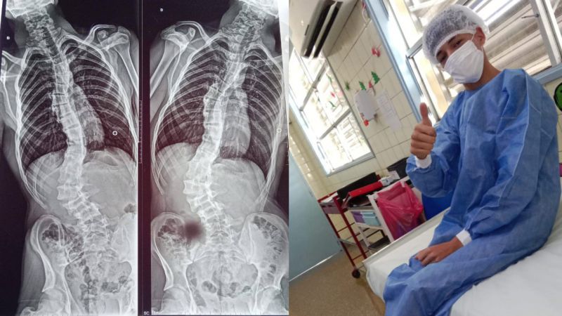 Sebastián Ferreyra fue operado con éxito: "Salió re bien" (video)