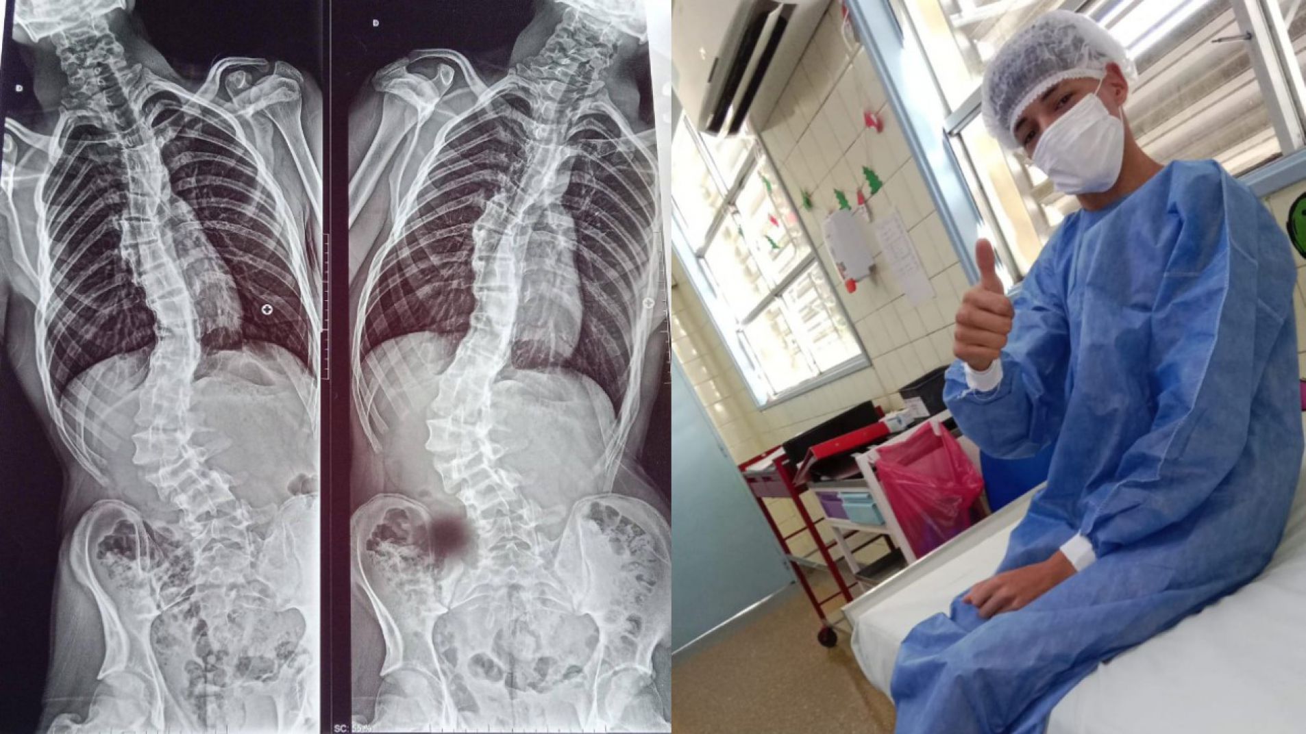 Sebastián Ferreyra fue operado con éxito: "Salió re bien" (video)