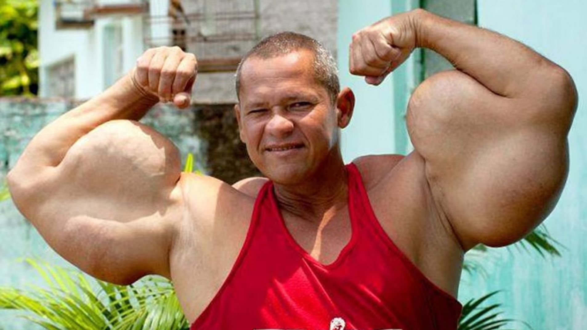 Murió "Popeye": se inyectaba aceite para tener bíceps de 73 centímetros