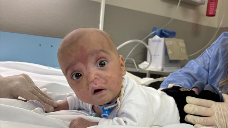 Piden oraciones por Benja, el bebé quemado tras una falla en su incubadora