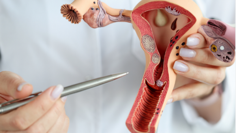 Día Mundial de la Endometriosis: no naturalizar el dolor es cuidar la fertilidad