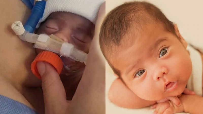 El bebé que nació pequeño a los ojos del mundo, pero grande en el plan de Dios