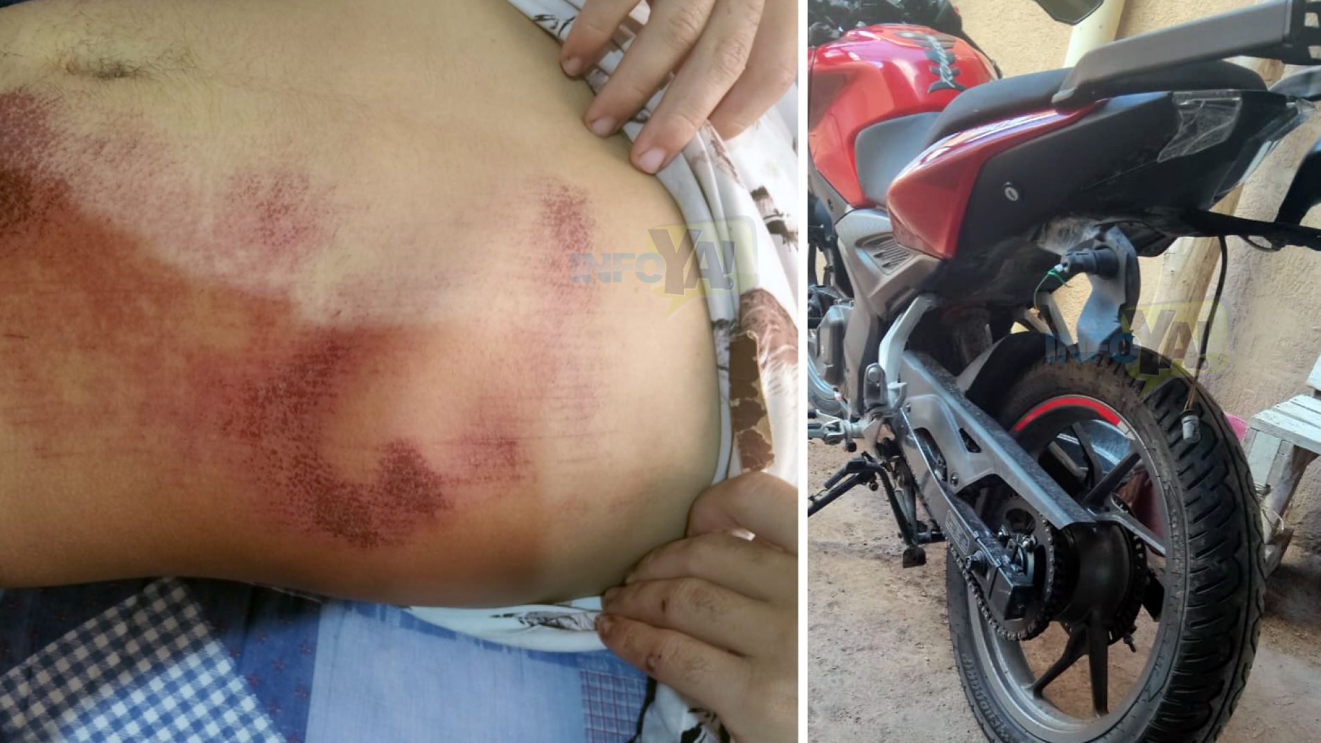 El choque le provocó lesiones a Juan y daños en su moto.