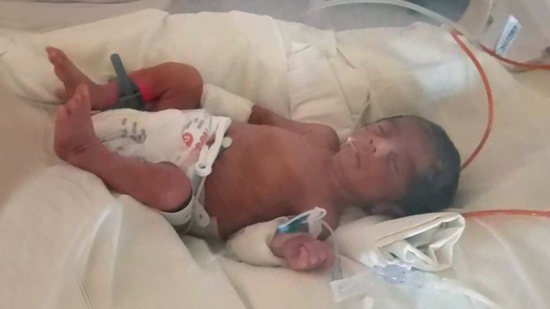Beba prematura: su familia está en el albergue y necesitan ayuda
