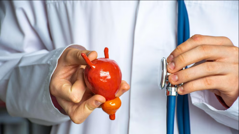 Cáncer de vejiga: síntomas y factores de riesgo detrás del 70% de los casos