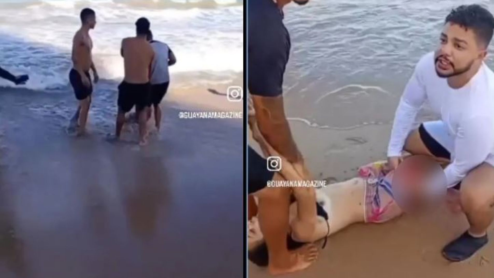 La mujer perdió una pierna por el ataque del tiburón.