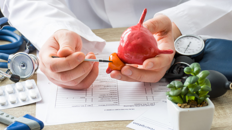 Cáncer de Próstata: el tumor que más afecta a los hombres y no da síntomas